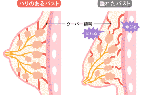 クーパー靭帯